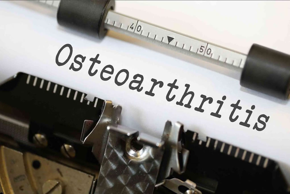 Best Supplements For Osteoarthritis